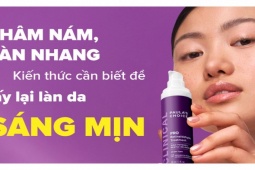 Thâm nám, tàn nhang - Những kiến thức cần biết để cải thiện làn da sáng mịn hơn