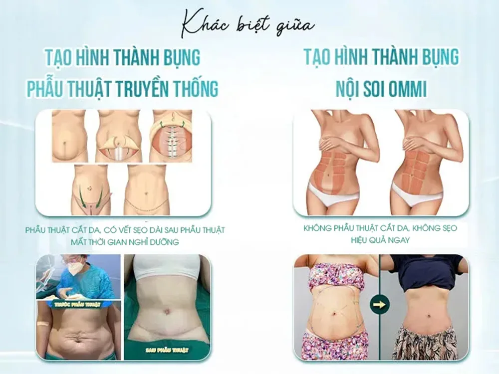 Tiên phong tại Việt Nam “Tạo hình thành bụng nội soi Ommi” từ Bệnh viện thẩm mỹ JK Nhật Hàn - 2