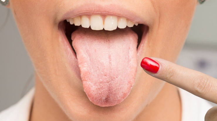 Ảnh minh họa: Fortitute Valley Dentist